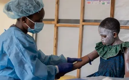 منظمة الصحة العالمية: لقاحات جدري القردة ستصل إلى الكونغو خلال أيام