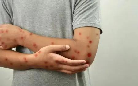 وزارة التربية الوطنية تطلق حملة وقائية للتصدي لداء الحصبة بالمؤسسات التعليمية