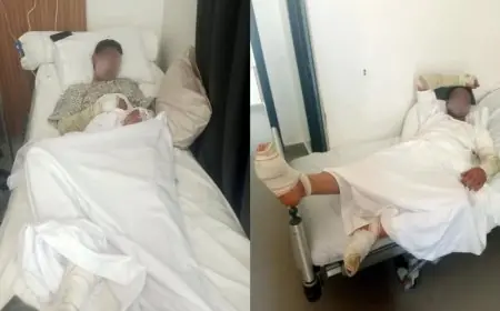 الصويرة.. إصابة بحارين بحروق بليغة في حادث تسرب غاز منزلي