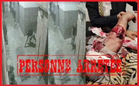 توقيف شخص اعتدى على جاره وزوجته بالحجارة والسلاح الأبيض بأكادير