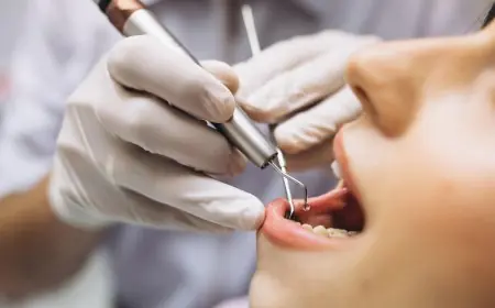 تسوس الأسنان يهدد صحة الدماغ.. دراسة تربط البكتيريا بمرض باركنسون
