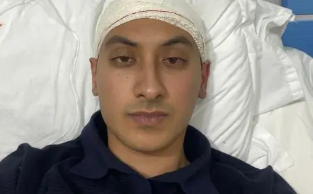 سقطت عليه عارضة حديدية.. ضحية حادث معرض الكتاب بالرباط يكشف مستجدات حالته الصحية وينتقد صمت المنظمين