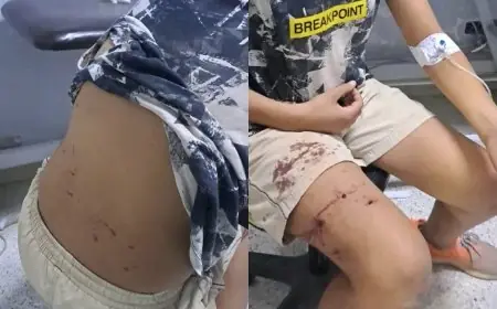 كلاب ضالة تهاجم طفلا بمراكش.. إلى متى يستمر صمت مجلس المنصوري أمام الخطر الذي يهدد الساكنة؟