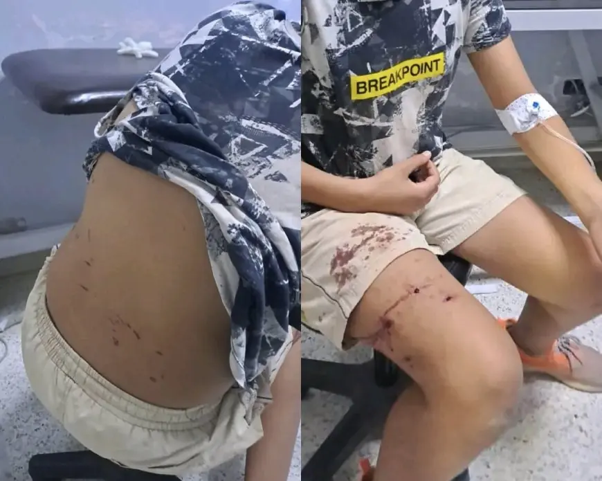 كلاب ضالة تهاجم طفلا بمراكش.. إلى متى يستمر صمت مجلس المنصوري أمام الخطر الذي يهدد الساكنة؟
