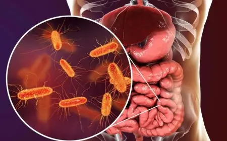 دراسة تكشف صلة بين بكتيريا الأمعاء ومستوى الذكاء لدى الإنسان