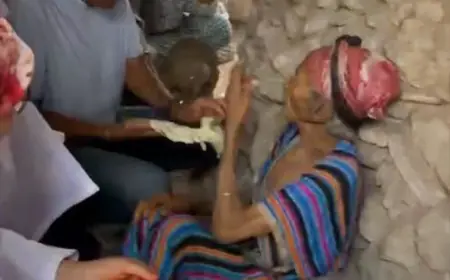 بعد صدمة صور وضعها المعيشي.. هكذا وصلت أطقم طبية إلى منزل المسنة حسبية