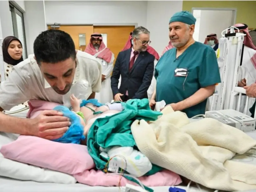 فريق طبي سعودي ينجح في فصل توأم مغربي