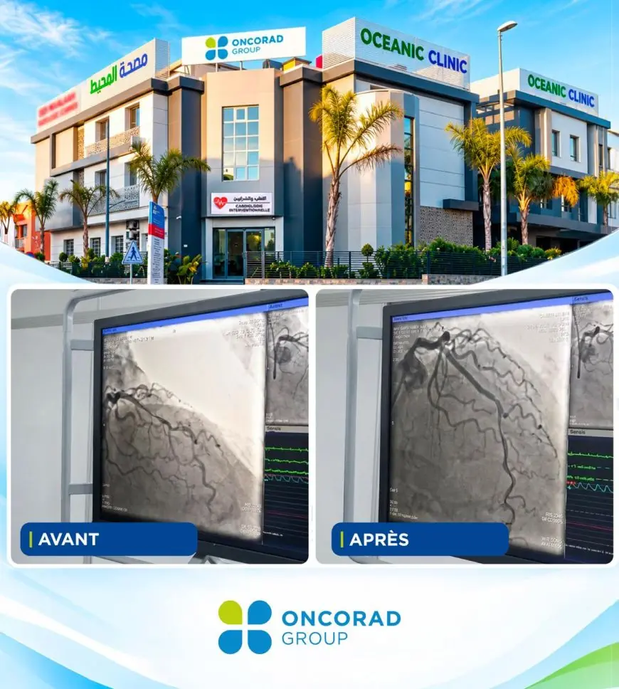 Casablanca : Oceanic Clinic El Hana réalise une première lithotripsie intracoronaire chez un patient de plus de 70 ans